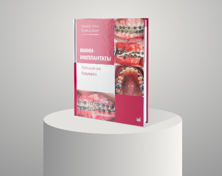 Новое поступление! Книга "Мини-имплантаты. Ортодонтия будущего" - авторы С. Эллуз, Ф. Дарке.