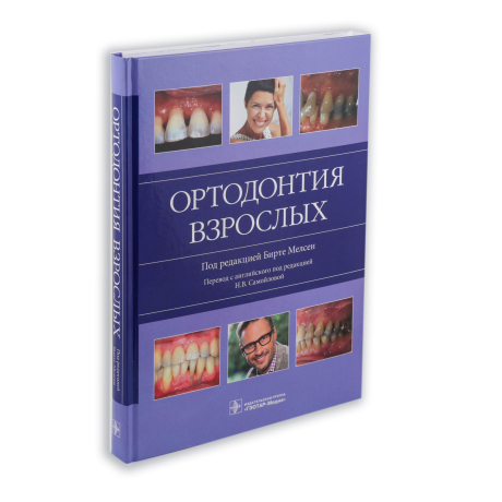Книга "Ортодонтия взрослых" под ред. Б. Мелсен; Пер. с англ.; под ред. Н.В. Самойловой