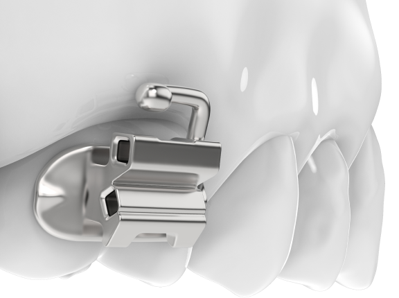 Замки-Трубки