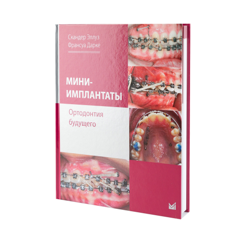 Книга "Мини-имплантаты. Ортодонтия будущего" авторы Скандер Эллуз, Франсуа Дарке