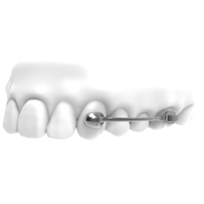 Специальные приспособления