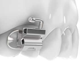 Замки-Трубки