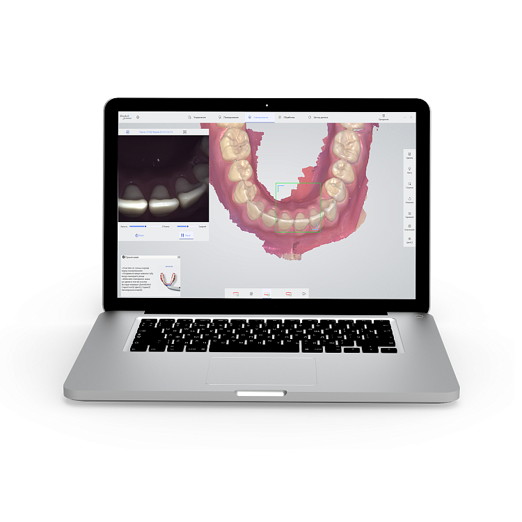 Сканер интраоральный "Пумпа" для создания цифровых снимков зубов (версия 1)
