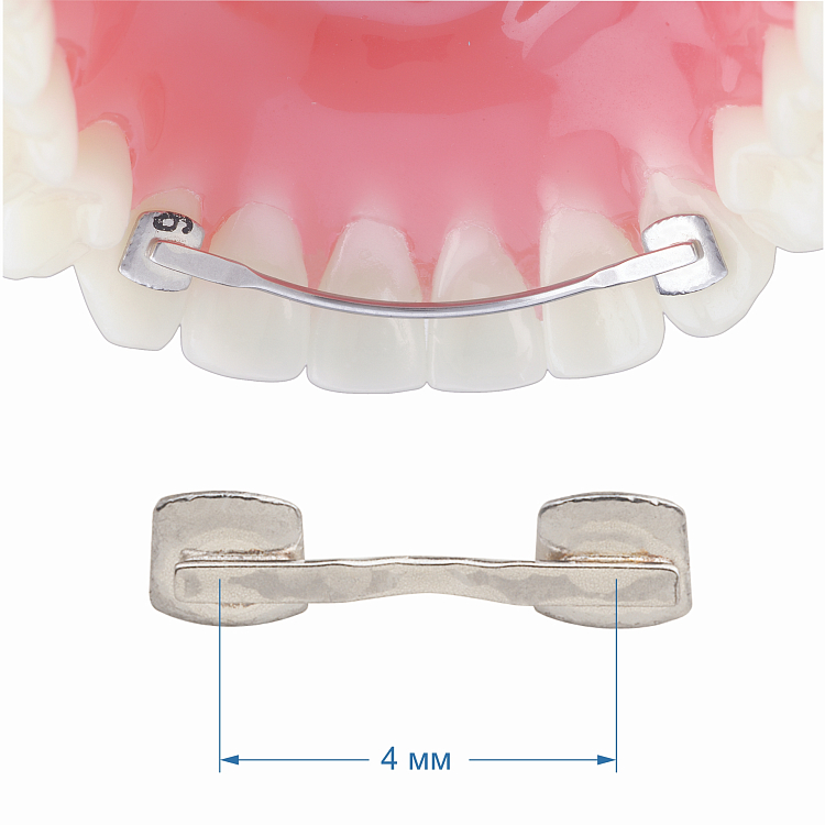Лингвальный ретейнер (1х1) 4 мм